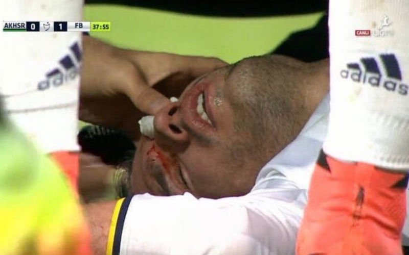 Grote paniek: Van Persie loopt vreselijke oogblessure op (Video)